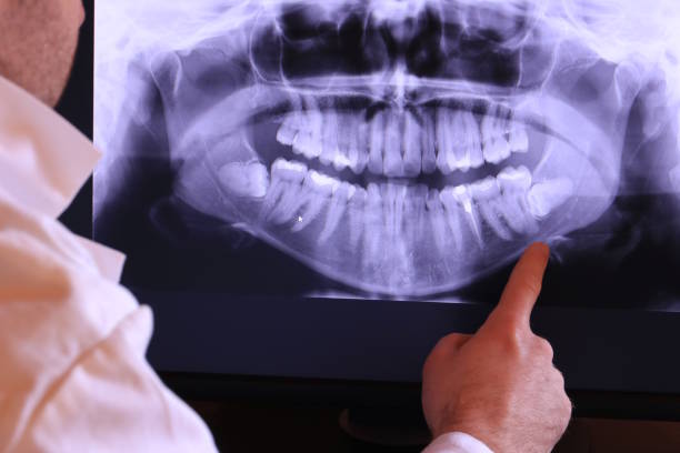 Best Orthodontic Emergency Dentist in Kilgore, TX