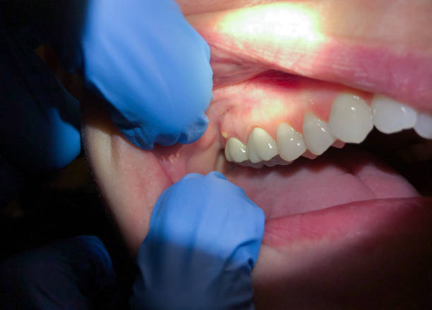 Best Broken or Cracked Tooth Emergency Dentist in Kilgore, TX